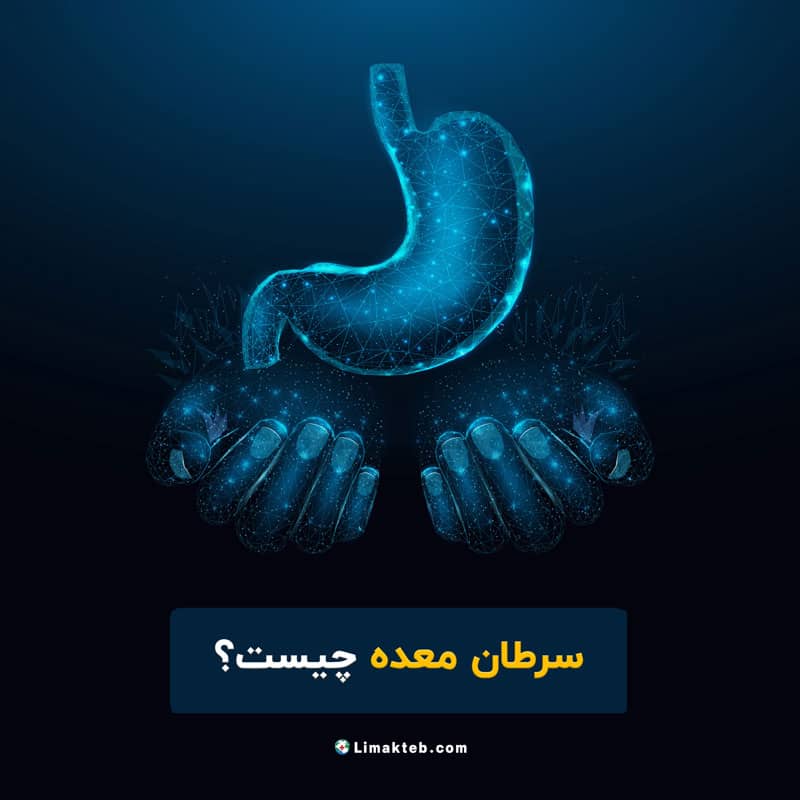 سرطان معده چیست؟