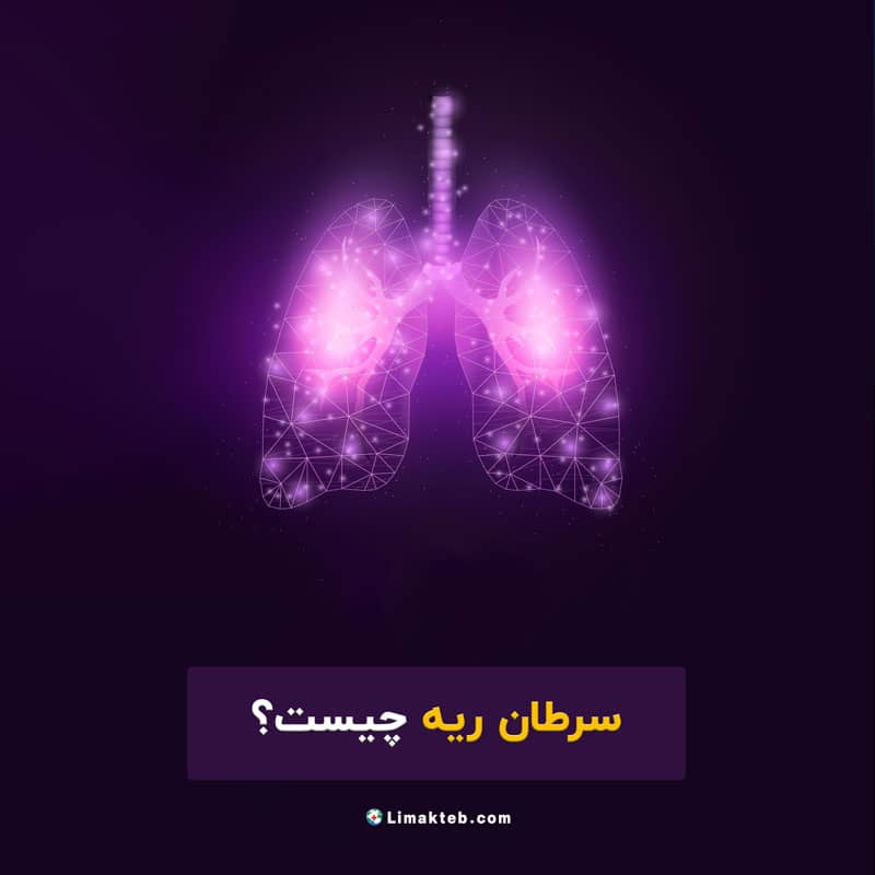سرطان ریه چیست؟